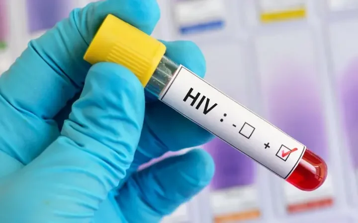 Juazeiro do Norte registra 28 casos de HIV entre janeiro e agosto de 2026