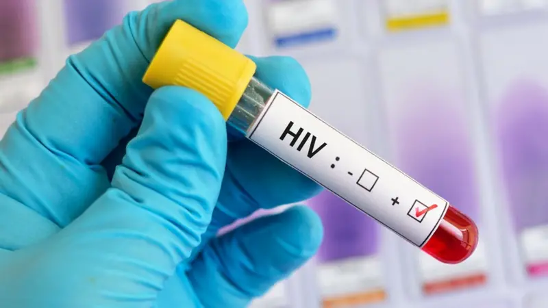 Juazeiro do Norte registra 28 casos de HIV entre janeiro e agosto de 2026